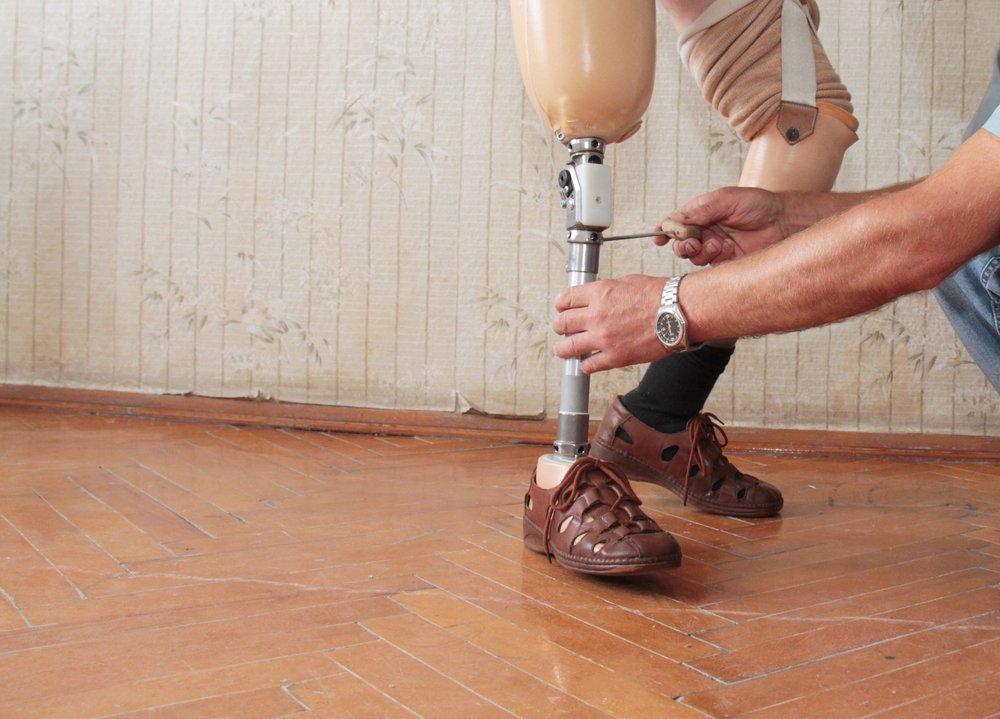 Hand Adjusting Prosthetic Leg Hand Adjusting Prosthetic Leg